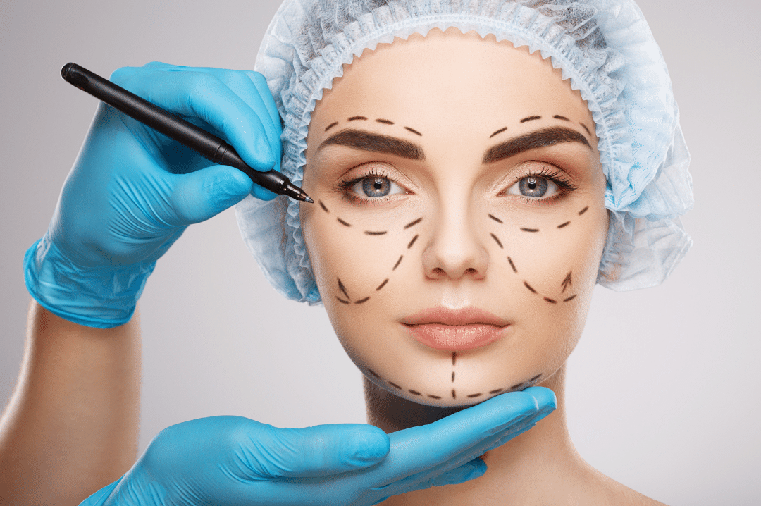 FACE SURGERY